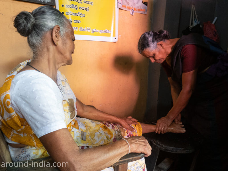 スリランカの伝統医、整骨治療